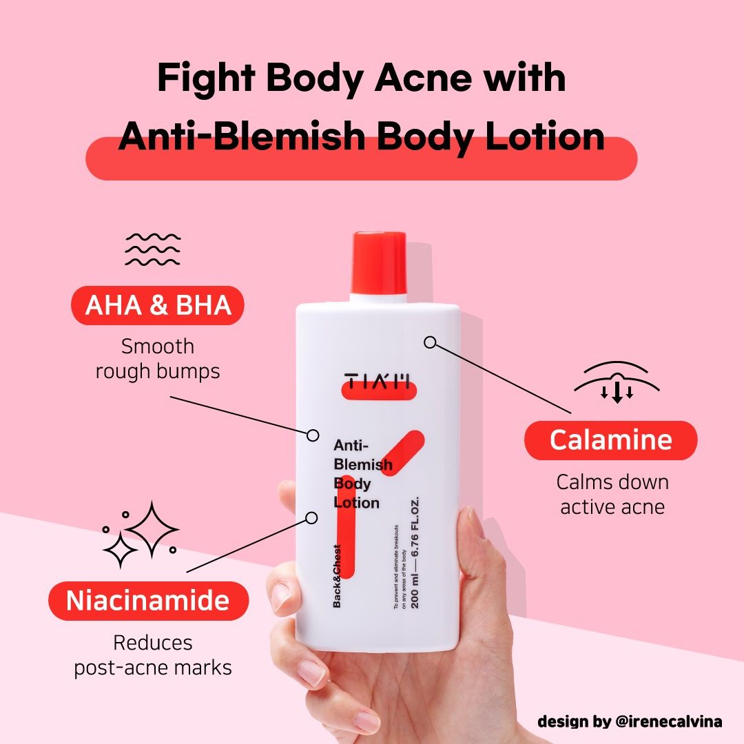 Tiam Anti-Blemish Body Lotion (200ml)