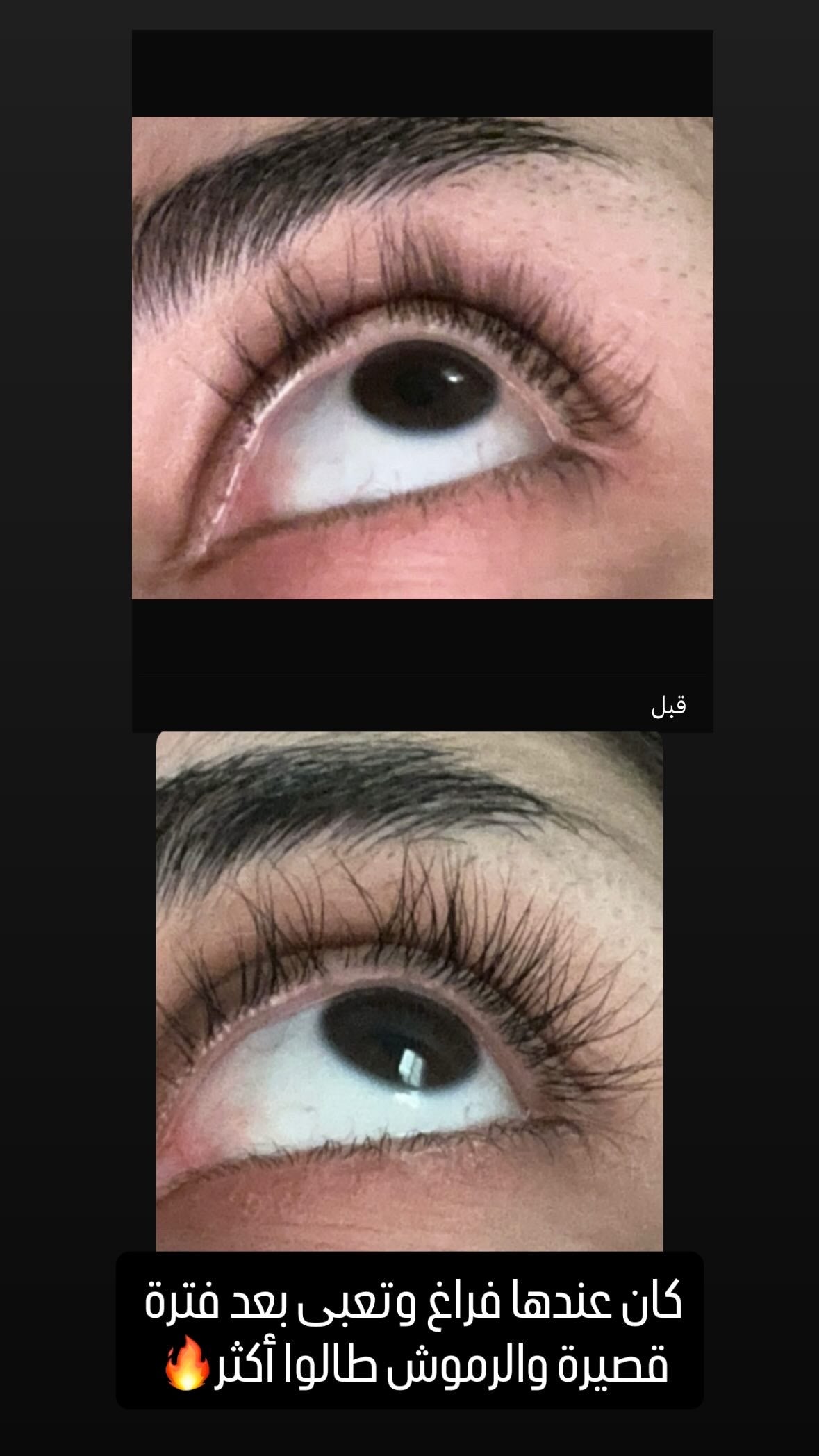 Careprost Drop + Brush (3ml)