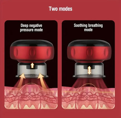Electric Cupping Set, Smart Dynamic Cupping Machine Cupping Device Cellulite Massager 4in 1