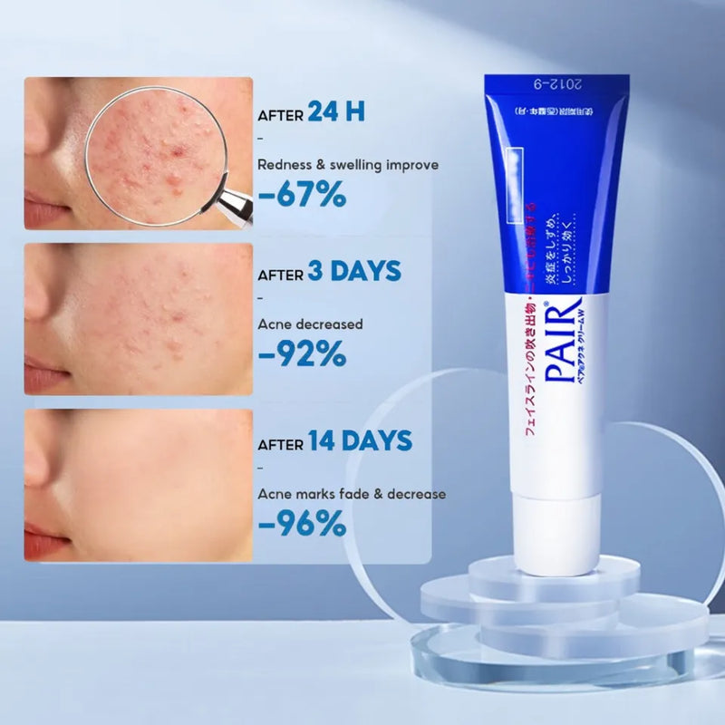 LION Pair Acne Cream W (24g)