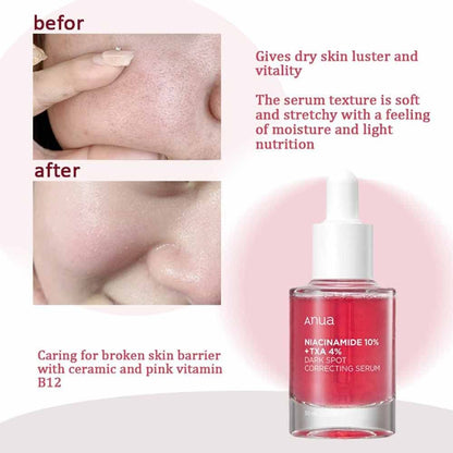 Anua Dark Spot Correcting Serum (30ml)