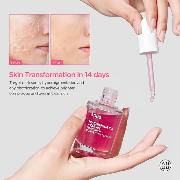 Anua Dark Spot Correcting Serum (30ml)