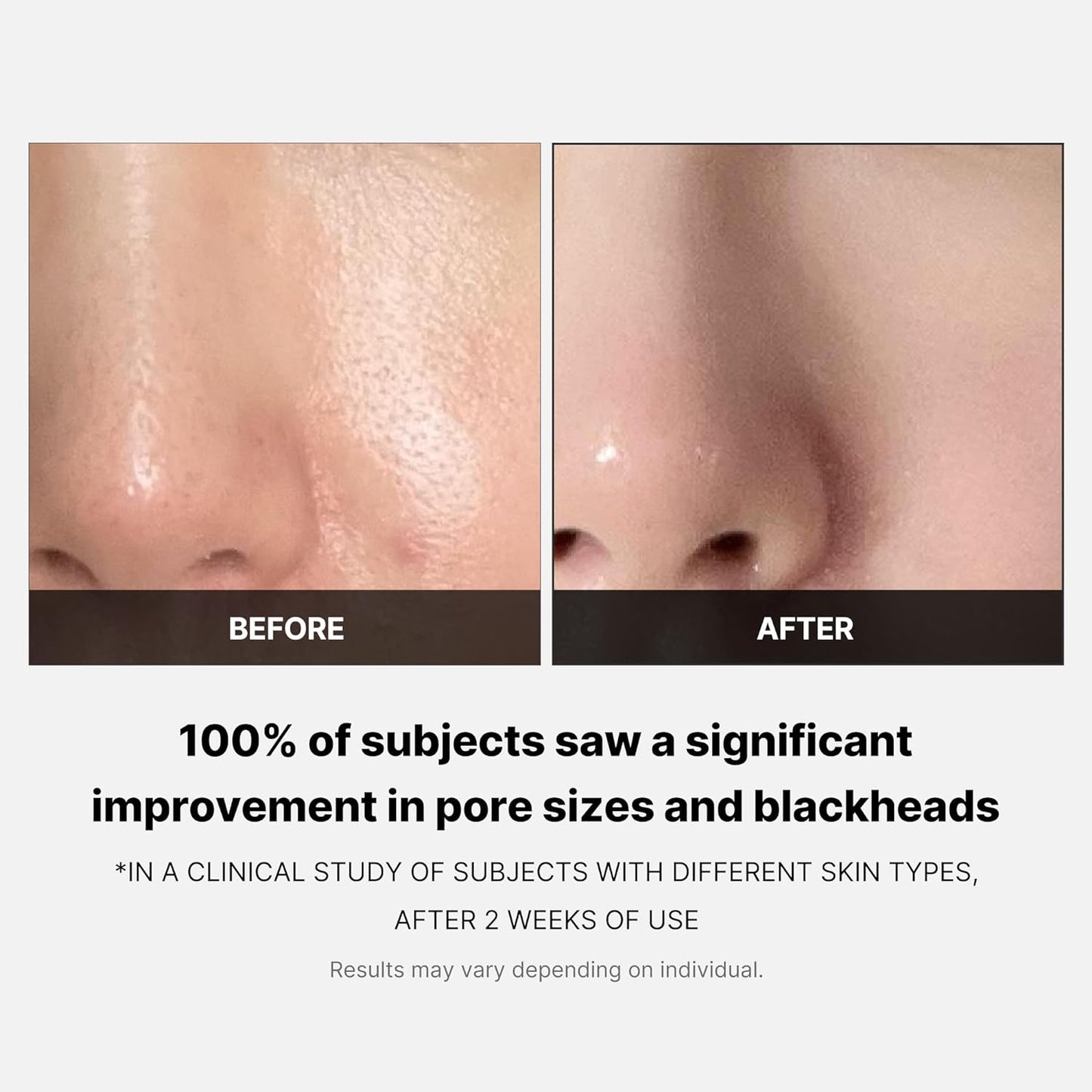 MEDICUBE Zero Pore Pad 2.0 (70ea)