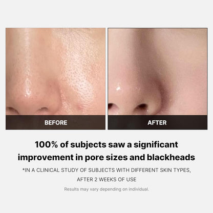 MEDICUBE Zero Pore Pad 2.0 (70ea)